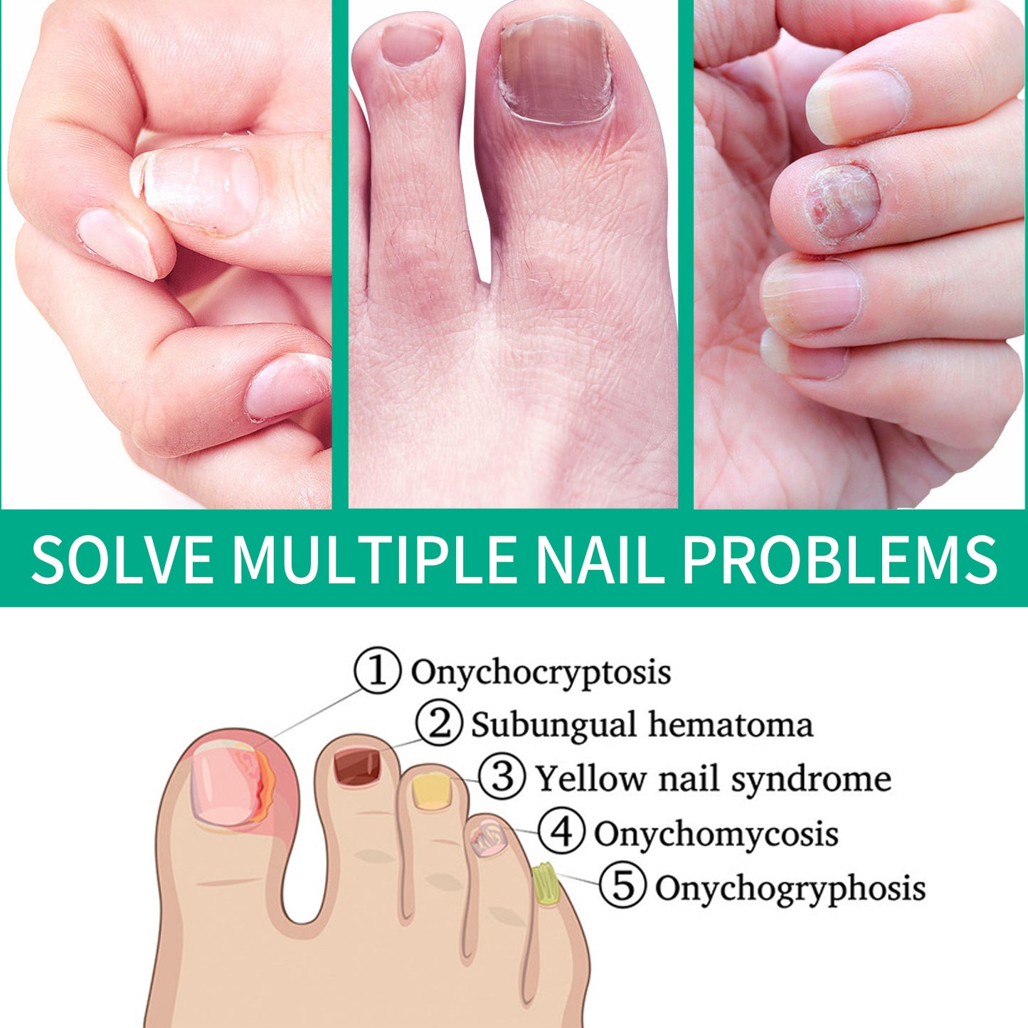 OUHOE Nail Care Nail Soft Nail Care Daily Cleansing Gentle Care Moisturizing Bright Nail Care Solution