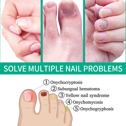 OUHOE Nail Care Nail Soft Nail Care Daily Cleansing Gentle Care Moisturizing Bright Nail Care Solution